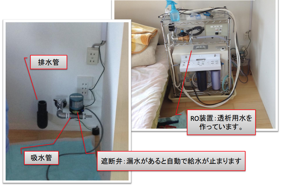 在宅血液透析設備・実例1